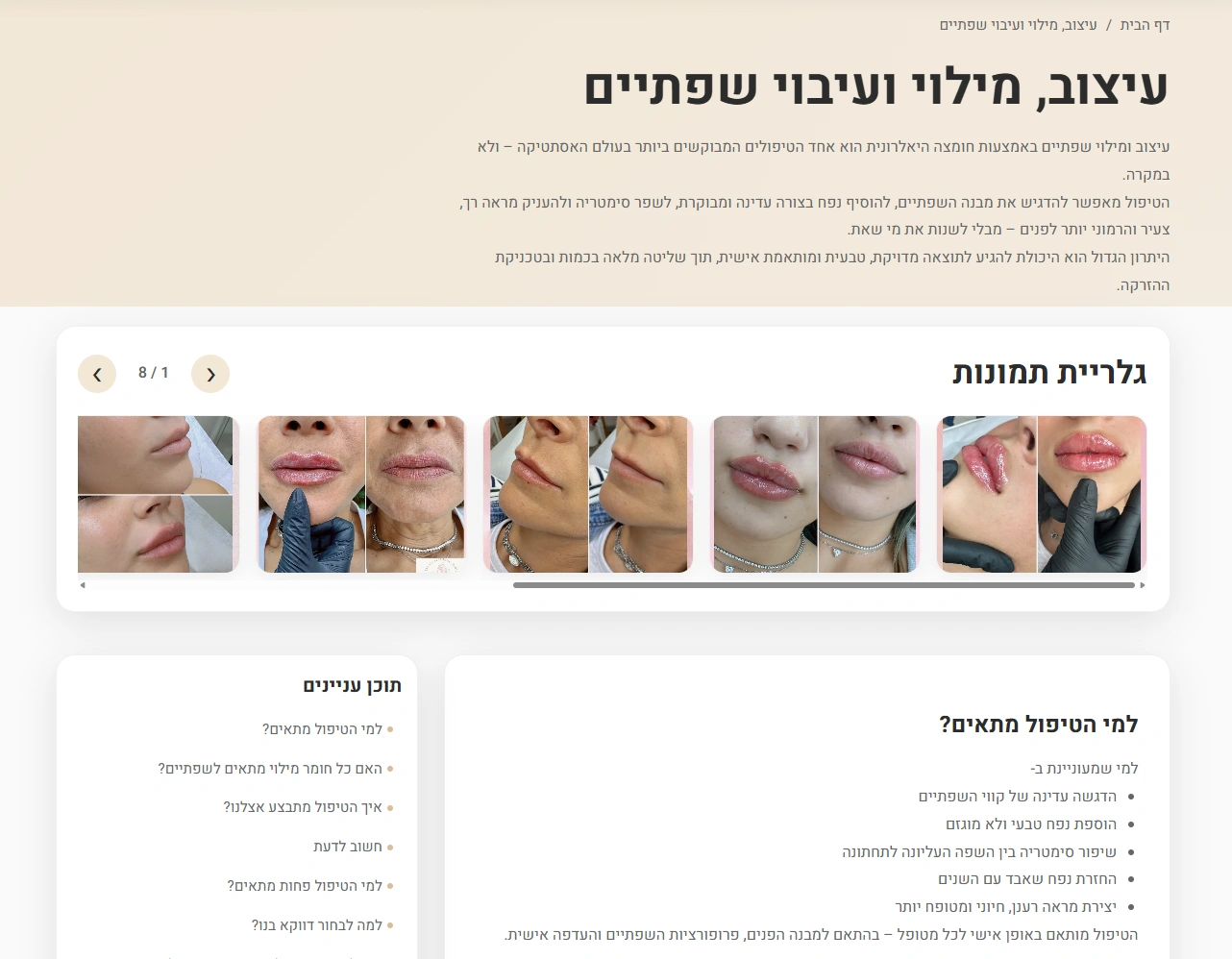 jclinic.co.il service page screenshot featuring the gallery and automated table of contents